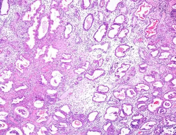 Gebaermutterschleimhaut in der Lutealphase