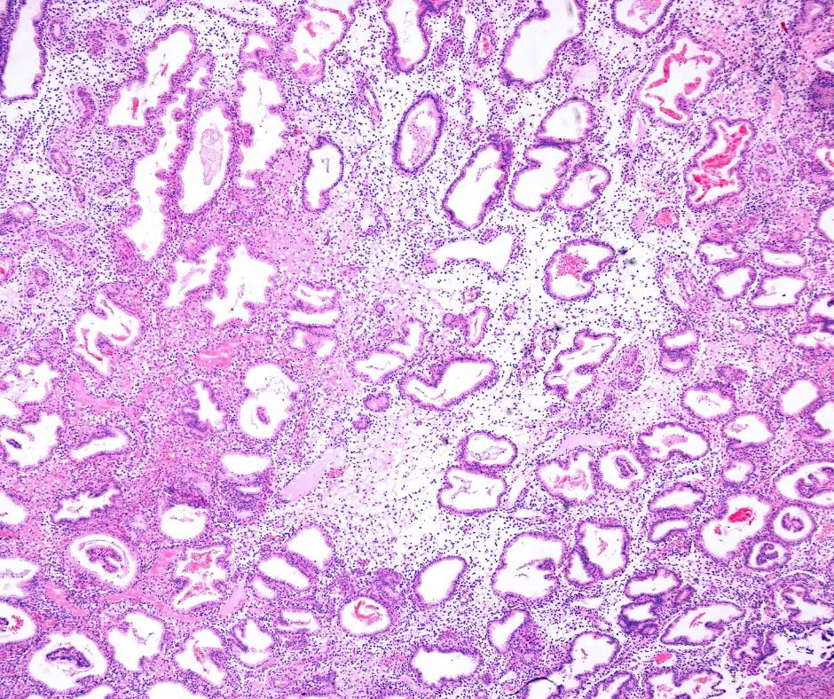 Gebaermutterschleimhaut in der Lutealphase