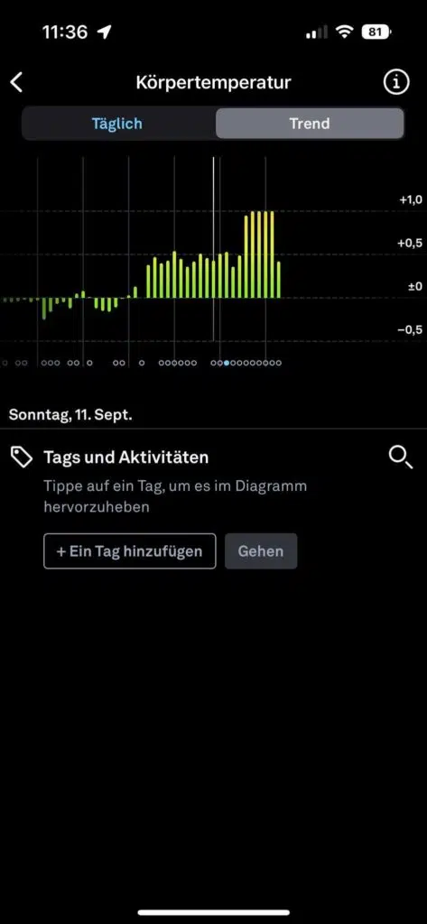Der Oura Ring erkennt einen Temperaturunterschied, der auf einen Eisprung hindeutet.